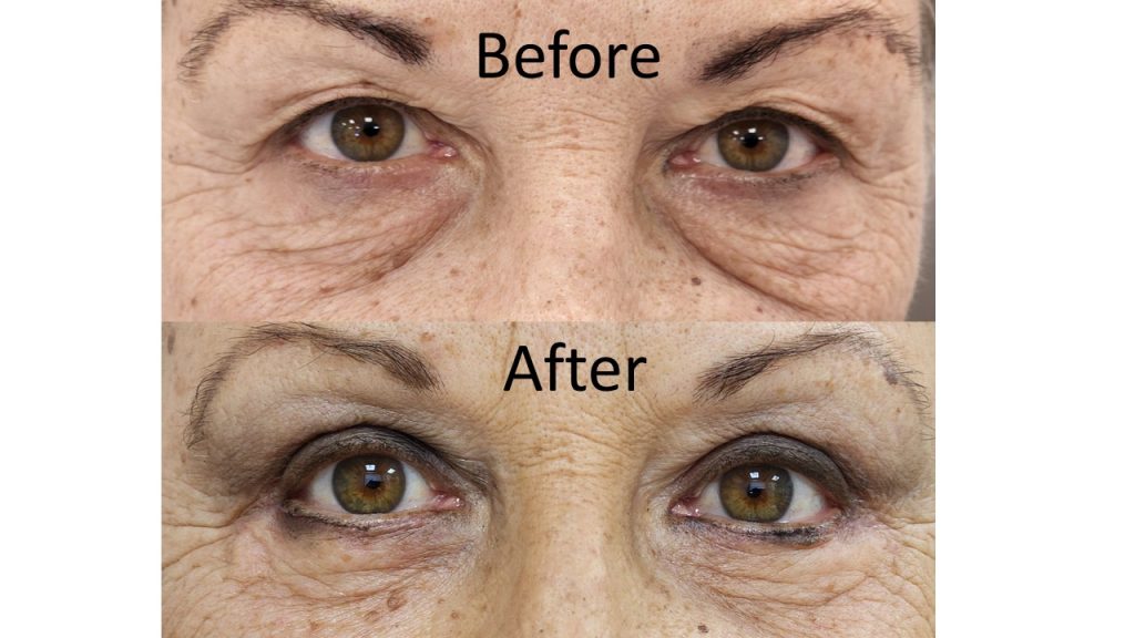 עליון תחתון